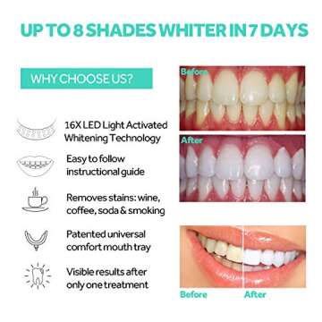 Teeth Whitening Accelerator Light - 16 Powerful Blue LEDs