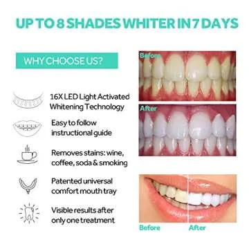 Teeth Whitening Accelerator Light - 16 Powerful Blue LEDs