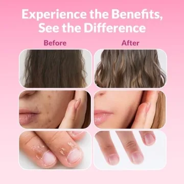 FLORATIN Hair, Skin, and Nails Vitamins for Women