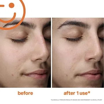 Kate Somerville ExfoliKate Cleanser for Radiant Skin