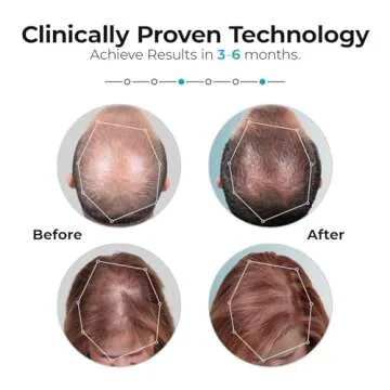 Capillus Pro Mobile Laser Therapy Cap for Hair Regrowth, with 272 Red Light Lasers for Laser Hair Growth, Red Light Hair Growth