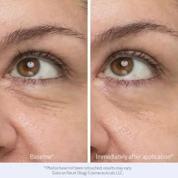 Obagi Daily Hydro-Drops Eye Gel Cream for Bright Eyes