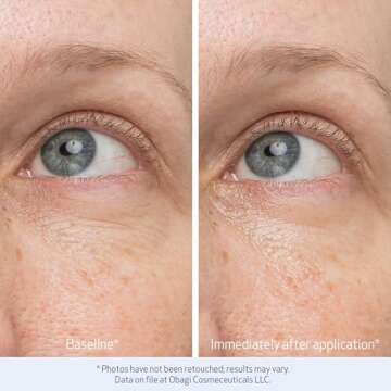 Obagi Daily Hydro-Drops Eye Gel Cream for Bright Eyes