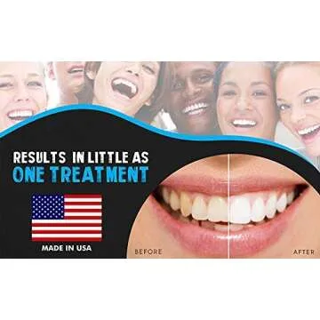 Bright White Smiles Teeth Whitening Kit, 35% Carbamide Peroxide Gel for Professional Results at Home, Whiter Refill System Includes 5X 5cc/ml Syringes