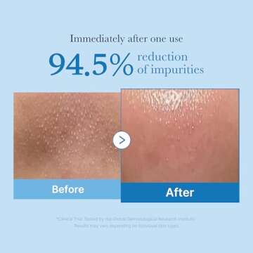 medicube Zero Pore Blackhead Deep Cleansing Oil | Makeup Remover for all skin types, Daily Moisture ...