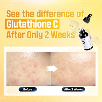 numbuzin No.5 Serum | Brighten Skin & Reduce Dark Spots