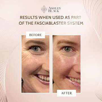 Ashley Black The Skin Invigorator for Ultimate Skin Renewal