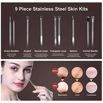 Newbealer Facial Steamer for Deep Cleaning and Relaxation