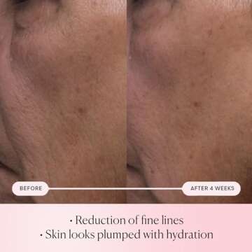 ELEMIS Hydration Serum for Youthful Skin Glow