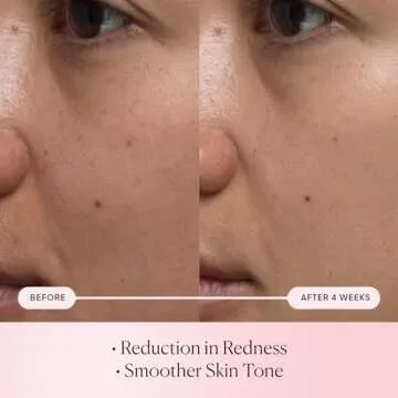 ELEMIS Hydration Serum for Youthful Skin Glow