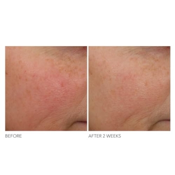 Dr Dennis Gross Overnight Wrinkle Treatment for Youthful Skin