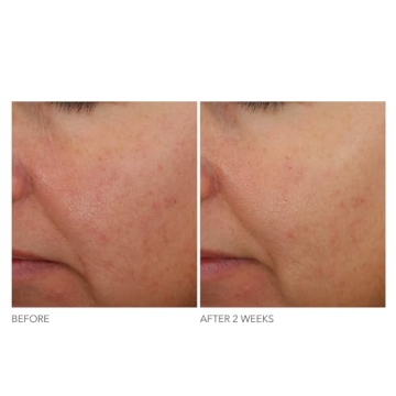 Dr Dennis Gross Overnight Wrinkle Treatment for Youthful Skin