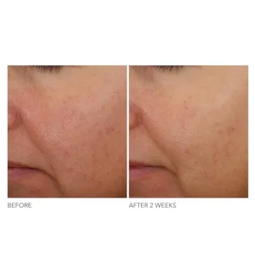 Dr Dennis Gross Overnight Wrinkle Treatment for Youthful Skin