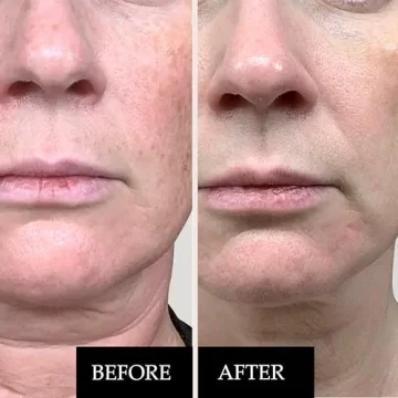 Kleem Organics Vitamin C Serum - Anti-Aging & Brightening