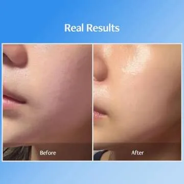 Bluelayer Double Water Cream - Hydrating Moisturizer for All Skin