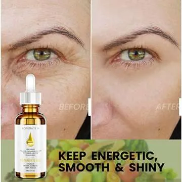 Nourish Skin & Hair with HOPEMATE H Vitamin E Oil