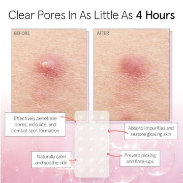 grace & stella Hydrocolloid Acne Patches - Cute & Effective