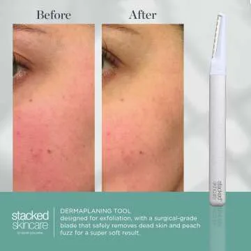 Dermaplaning Tool for Glowing Skin - Easy Hair Removal