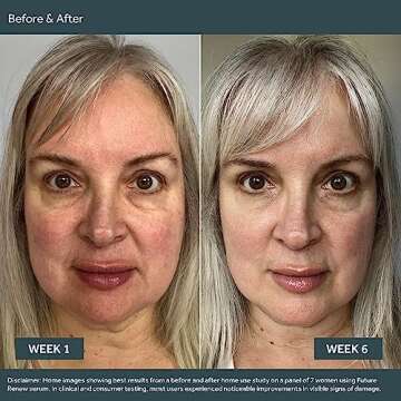 No7 Future Renew Damage Serum for Glowing Skin - 0.84 Fl Oz