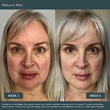 No7 Future Renew Damage Serum for Glowing Skin - 0.84 Fl Oz