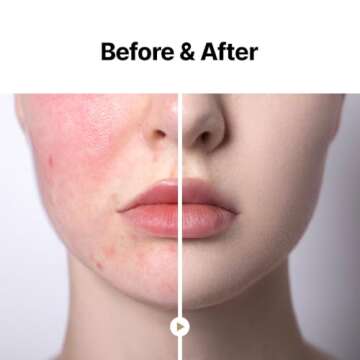 MAY COOP Moisture Essence Toner for Hydrating Skin