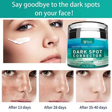 Paradise Emerald Dark Spot Remover for Face, Hyperpigmentation Treatment, Melasma, Freckle, Sun Spot...