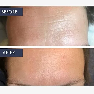 Anti Aging 0.5% Encapsulated Retinol Cream by bioBare®