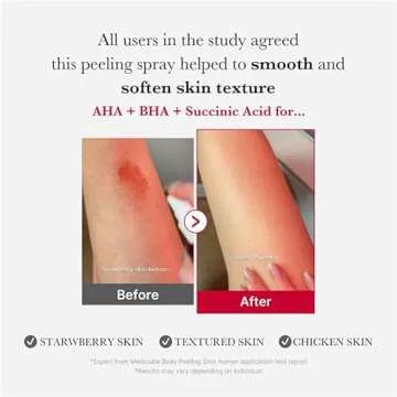medicube Red Body Peeling Shot, Body Spray Cleanser for Strawberry skin, AHA + BHA + Succinic Acid H...