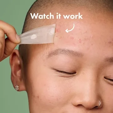 Mighty Patch Surface from Hero Cosmetics - Hydrocolloid Spot Patch for Body, Cheek, Forehead, and Chin, Vegan-friendly (10 Count)