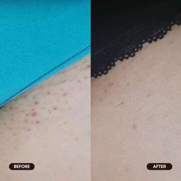 Bushbalm Exfoliating Ingrown Hair Pads for Smooth Skin