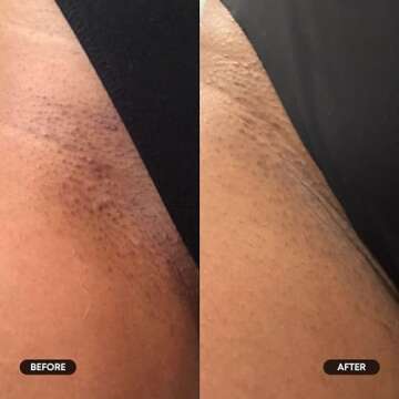 Bushbalm Exfoliating Ingrown Hair Pads for Smooth Skin