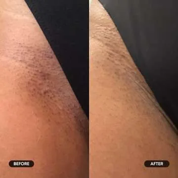 Bushbalm Exfoliating Ingrown Hair Pads for Smooth Skin