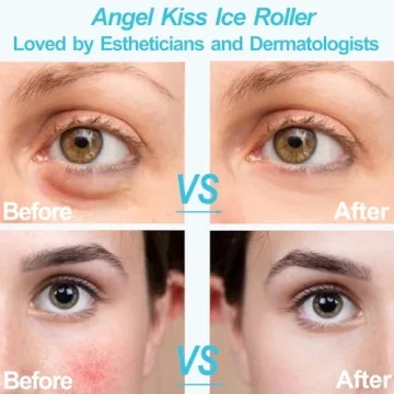 Angel Kiss Ice Roller for Face & Eye | Skincare Gift