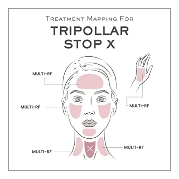 TriPollar Stop X - RF Facial Device for Anti-Aging
