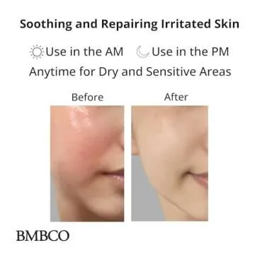 BMBCO The Cica Serum, Tiger Grass Soothing Moisturizer, Wrinkle Ampoule, Skin Repair, Redness Corrector, Blemish Reducer Essence, Korean Skin care