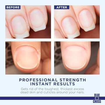 Blue Cross Cuticle Remover Cream for Dry Damaged Cuticles, Moisturizing Cuticle Softener for Nails, ...