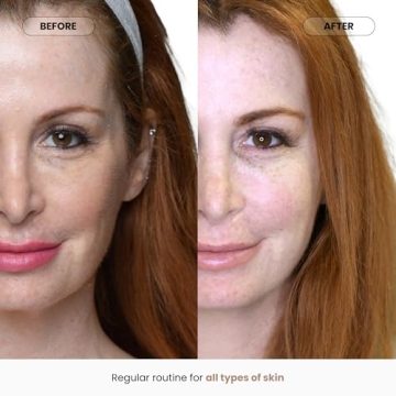 CO2Lift Carboxy Gel Mask for Hydrating Skin and Dark Circles Relief