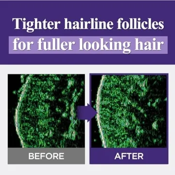 Dr. Groot Hair Loss Control Shampoo for Volumizing Health