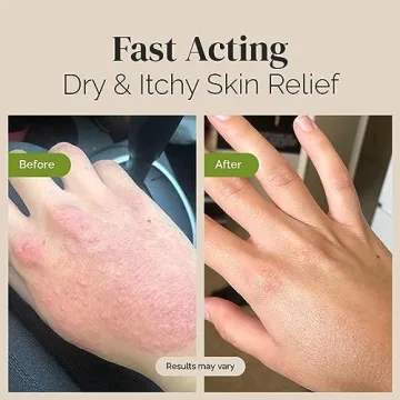 Puriya Eczema Relief Cream, Moisturizer for All Ages