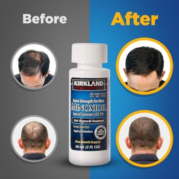 Minoxidil 5% Hair Regrowth Treatment for Men 6 Month Supply