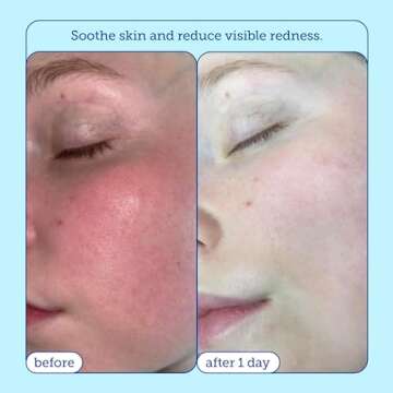 Skinfix Barrier+ Foaming Oil Cleanser: Gently Removes Dirt and Makeup, Reduces Visible Redness, Doesn’t Strip Skin Lipids, 6 Fl Oz