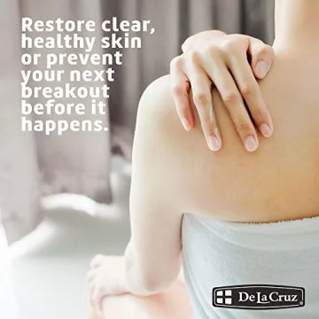 De La Cruz Sulfur Ointment - Acne Treatment Solution