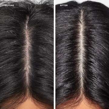 Paul Mitchell Clean Beauty Scalp Therapy Drops, Ultra-Lightweight Scalp Serum Soothes + Nourishes All Hair Types, Especially Dry, Oily + Sensitive Scalps, 1.7 fl. oz.