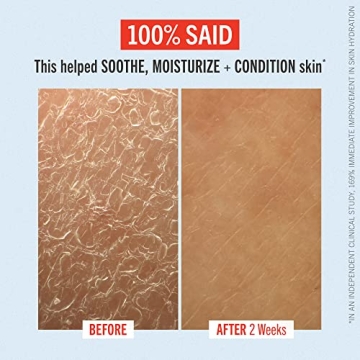 First Aid Beauty Ultra Repair Cream for Face and Body – Hydration