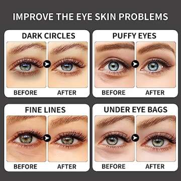 ROUSE Collagen Under Eye Patches with Caffeine Eye Treatment Mask for Dark Circles Eye Fatigue Puffiness Refreshing Revitalizing Skin Care Eye Gel Pads-20 Pairs