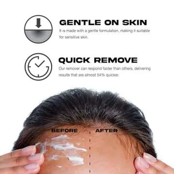 EBIN NEW YORK Wig Adhesive Remover Spray - Original 4.05oz/ 120ml | Fast Remover Wig Glue &Double Sided Hair Extensions Tape Adhesive| Gentle on Skin | Mist Pump & Nozzle Cap, Fast & Safe Remover