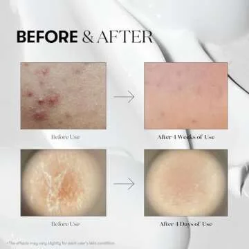 VT CICA Reedle Shot 50 for Glass Skin & Pore Care