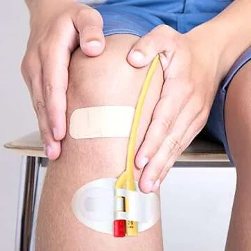 HEALLILY 6Pcs G-Tube Holder Concealment Gastrostomy Tubes Sticker Abdominal Feeding Tubes Dialysis Catheter Tube Holder Catheter Stabilization Device 1