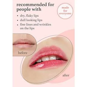 NOONI Vegan Appleseed Lip Oil - Applepeony | Long-Lasting, Moisturizing, Plumping, Revitalizing for Dry Lips, Waterproof, No Peel Off, Korean Tint, Hydrating, Nourishing Crystal Clear, 0.12 FL Oz