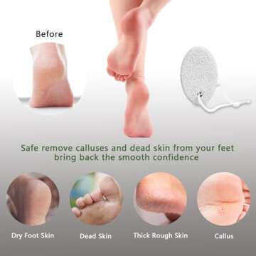 Natural Foot Pumice Stone for Feet, Borogo 2-Pack Lava Pedicure Tools Hard Skin Callus Remover for Feet and Hands - White&Red